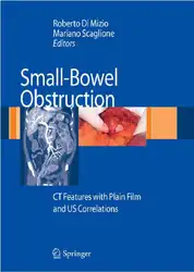 Small-Bowel Obstruction: CT... image