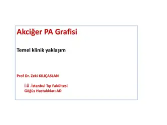 PA Akciğer Grafisi... image