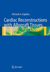 Cardiac Reconstructions with... image