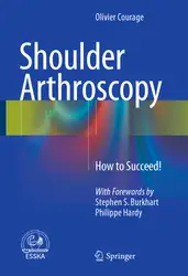 Shoulder Arthroscopy: How... image