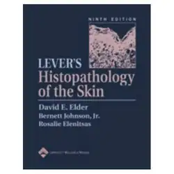 Lever's Histopathology of... image
