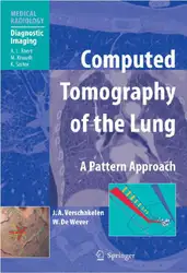 Computed Tomography of... image