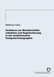 Verfahren zur Metallartefaktreduktion... image