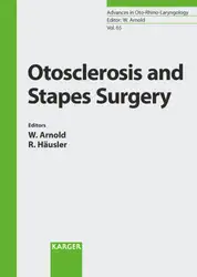 Otosclerosis And Stapes... image