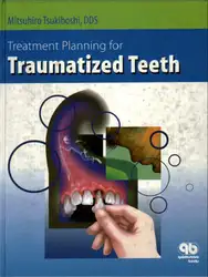 Treatment Planning for... image