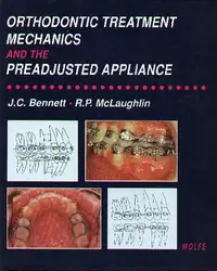 Orthodontic treatment mechanics... image