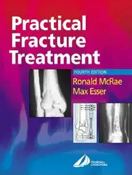 Practical Fracture Treatment image
