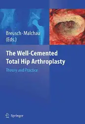 The Well-cemented Total... image