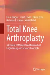 Total Knee Arthroplasty:... image