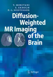 Diffusion-Weighted MR Imaging... image