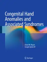Congenital Hand Anomalies... image