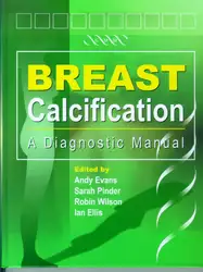 Breast Calcification- A... image