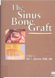 The Sinus Bone... image