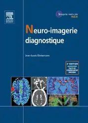 Neuro-imagerie diagnostique image
