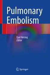 Pulmonary Embolism image